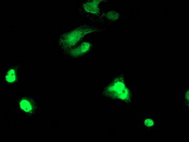 TAL1 Antibody in Immunocytochemistry (ICC/IF)