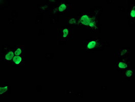 TAL1 Antibody in Immunocytochemistry (ICC/IF)