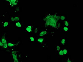 TAL1 Antibody in Immunocytochemistry (ICC/IF)