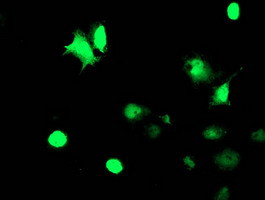 TAL1 Antibody in Immunocytochemistry (ICC/IF)