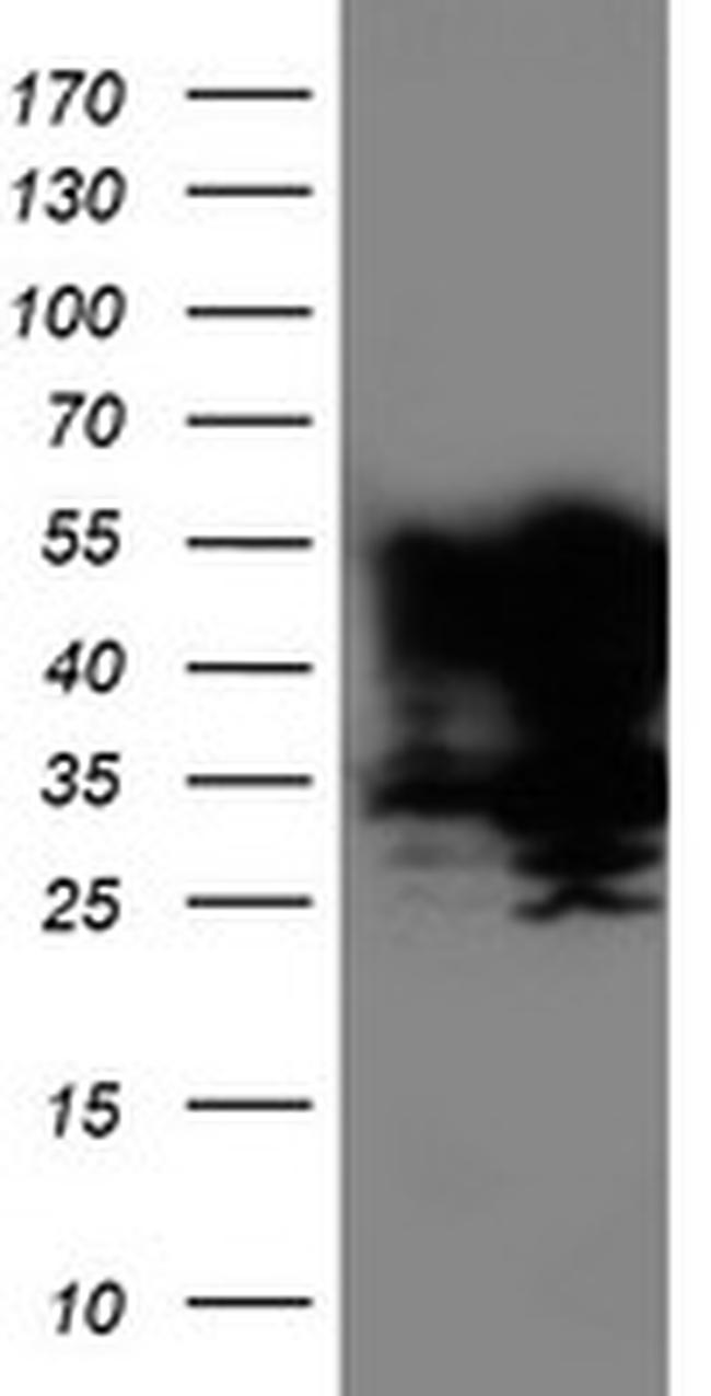 TAL1 Antibody in Western Blot (WB)