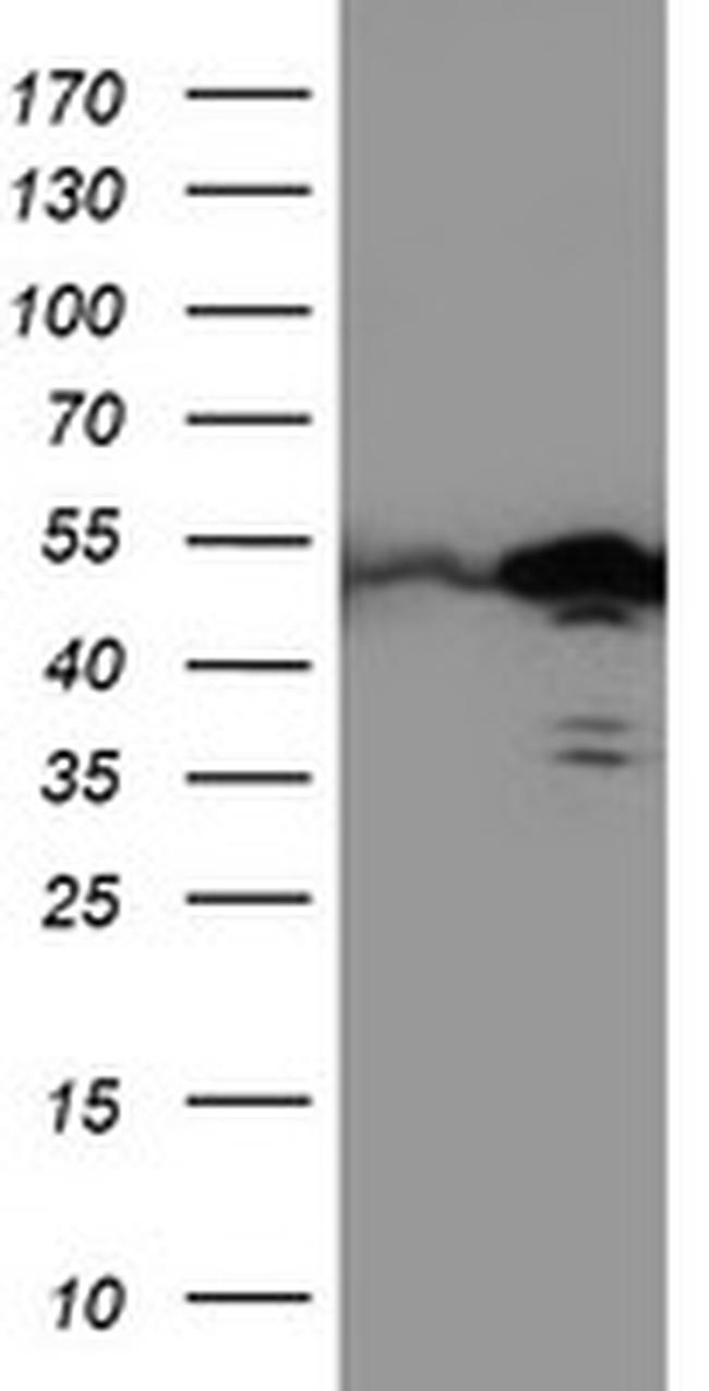 TAL1 Antibody in Western Blot (WB)