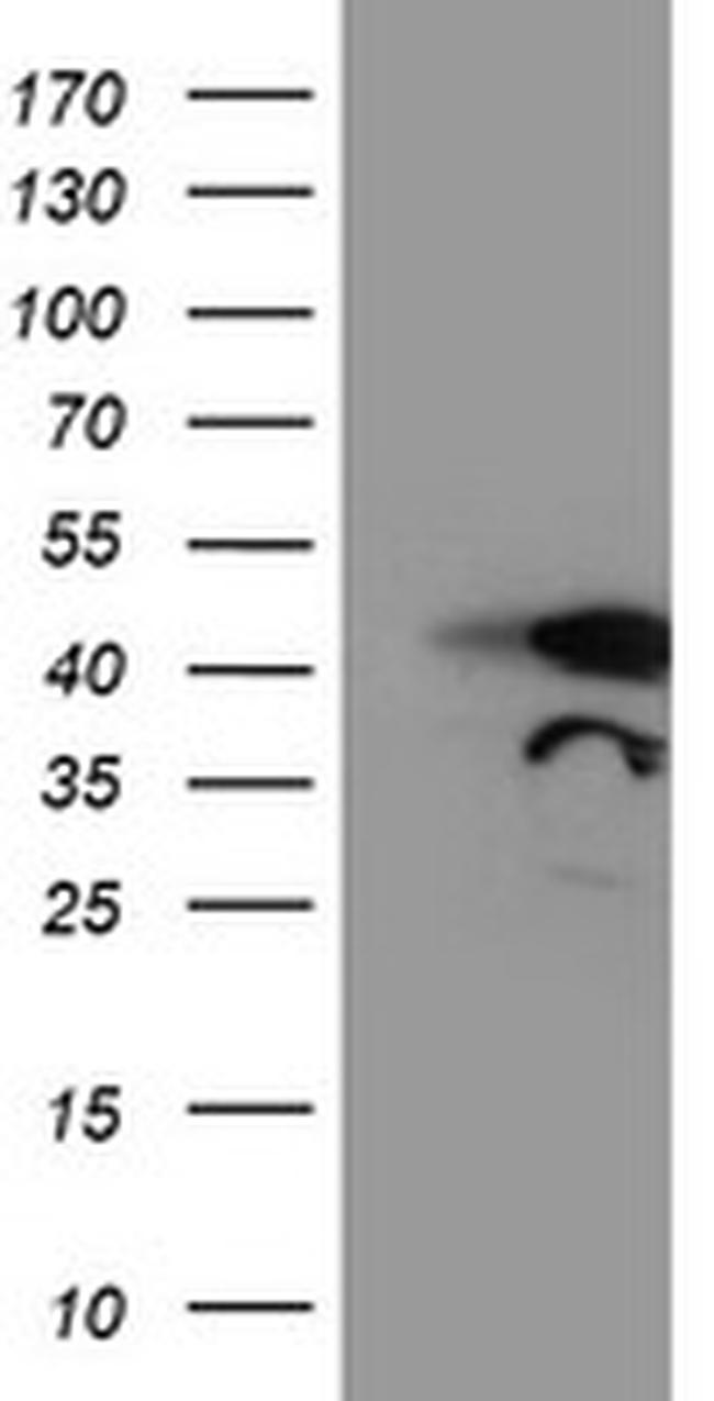 TAL1 Antibody in Western Blot (WB)