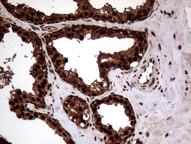 TALDO1 Antibody in Immunohistochemistry (Paraffin) (IHC (P))