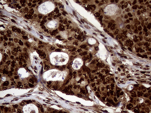 TALDO1 Antibody in Immunohistochemistry (Paraffin) (IHC (P))