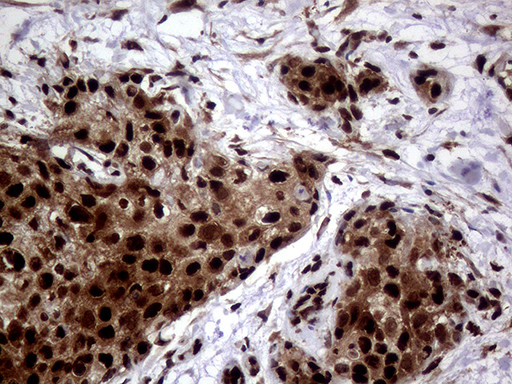 TALDO1 Antibody in Immunohistochemistry (Paraffin) (IHC (P))