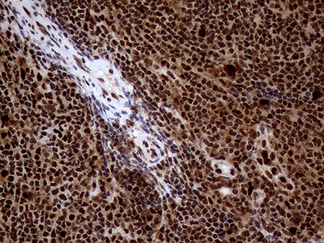 TALDO1 Antibody in Immunohistochemistry (Paraffin) (IHC (P))