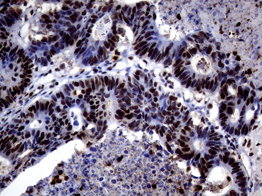 TALDO1 Antibody in Immunohistochemistry (Paraffin) (IHC (P))