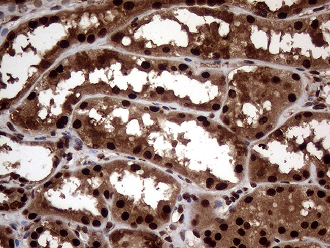 TALDO1 Antibody in Immunohistochemistry (Paraffin) (IHC (P))