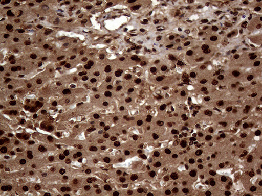 TALDO1 Antibody in Immunohistochemistry (Paraffin) (IHC (P))