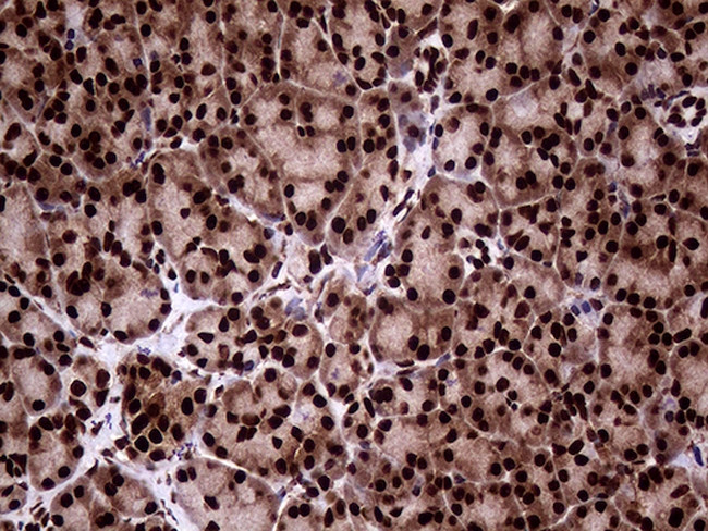 TALDO1 Antibody in Immunohistochemistry (Paraffin) (IHC (P))