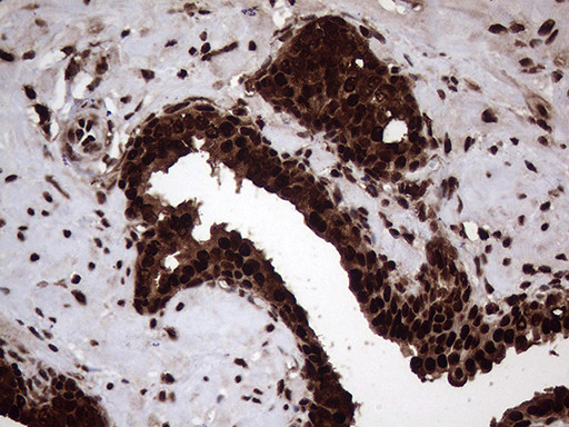 TALDO1 Antibody in Immunohistochemistry (Paraffin) (IHC (P))