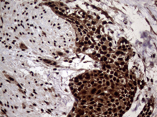 TALDO1 Antibody in Immunohistochemistry (Paraffin) (IHC (P))