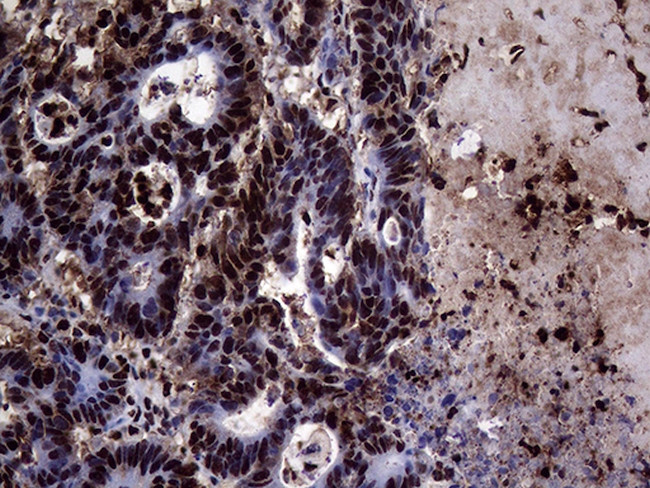 TALDO1 Antibody in Immunohistochemistry (Paraffin) (IHC (P))