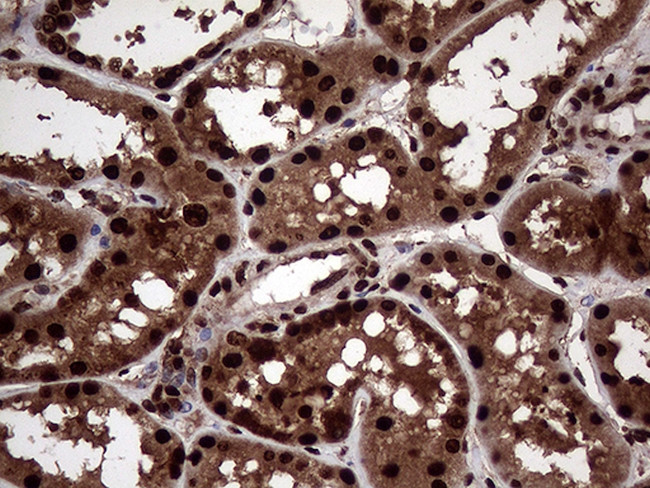 TALDO1 Antibody in Immunohistochemistry (Paraffin) (IHC (P))