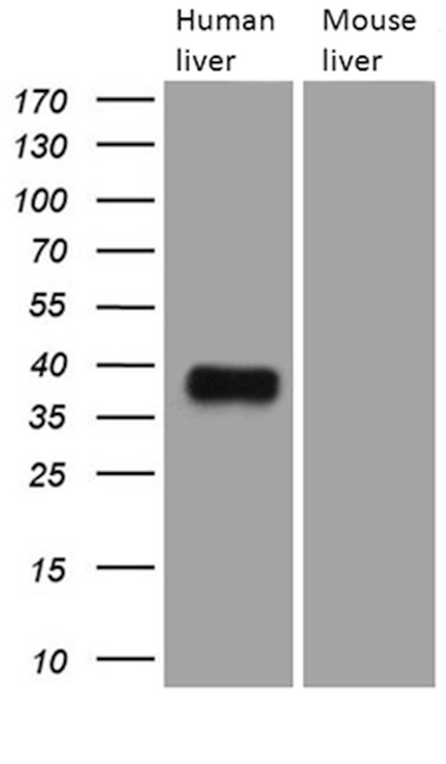 TALDO1 Antibody in Western Blot (WB)