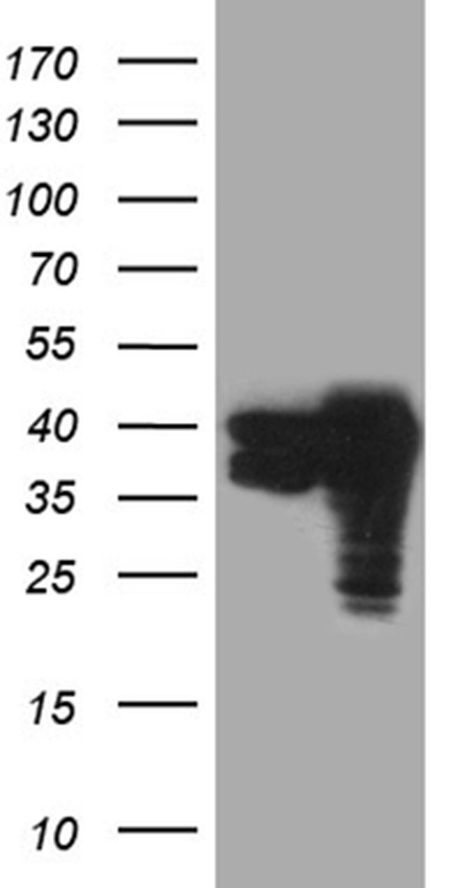 TALDO1 Antibody in Western Blot (WB)
