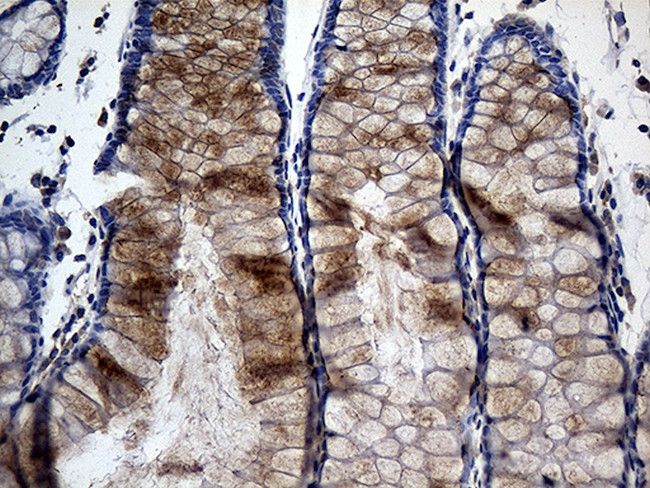 TANK Antibody in Immunohistochemistry (Paraffin) (IHC (P))