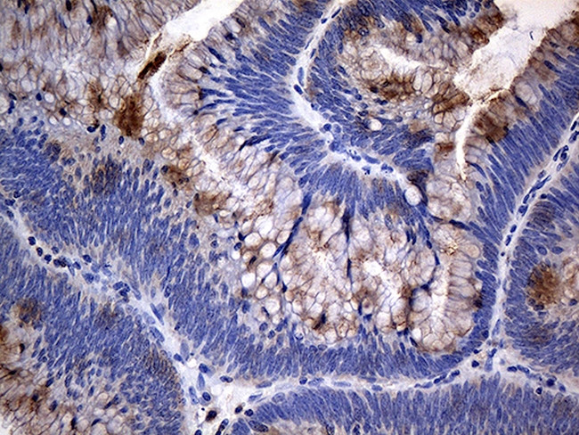 TANK Antibody in Immunohistochemistry (Paraffin) (IHC (P))