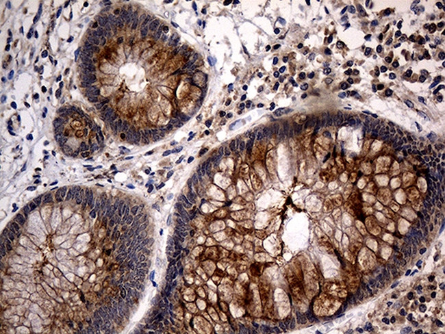 TANK Antibody in Immunohistochemistry (Paraffin) (IHC (P))