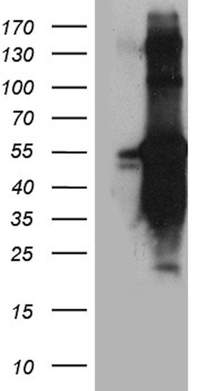 TANK Antibody in Western Blot (WB)