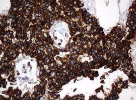 TAPBPL Antibody in Immunohistochemistry (Paraffin) (IHC (P))