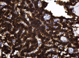 TAPBPL Antibody in Immunohistochemistry (Paraffin) (IHC (P))