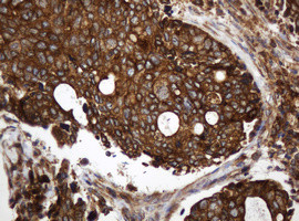 TAPBPL Antibody in Immunohistochemistry (Paraffin) (IHC (P))