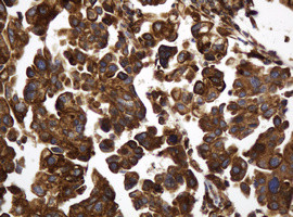 TAPBPL Antibody in Immunohistochemistry (Paraffin) (IHC (P))