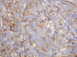 TAPBPL Antibody in Immunohistochemistry (Paraffin) (IHC (P))