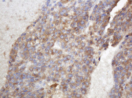 TAPBPL Antibody in Immunohistochemistry (Paraffin) (IHC (P))