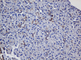 TAPBPL Antibody in Immunohistochemistry (Paraffin) (IHC (P))