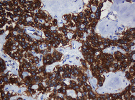 TAPBPL Antibody in Immunohistochemistry (Paraffin) (IHC (P))