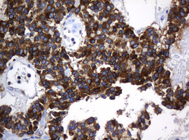 TAPBPL Antibody in Immunohistochemistry (Paraffin) (IHC (P))