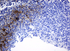 TAPBPL Antibody in Immunohistochemistry (Paraffin) (IHC (P))