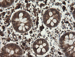 TAPBPL Antibody in Immunohistochemistry (Paraffin) (IHC (P))