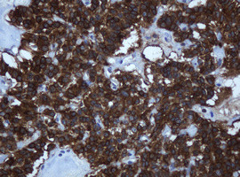 TAPBPL Antibody in Immunohistochemistry (Paraffin) (IHC (P))