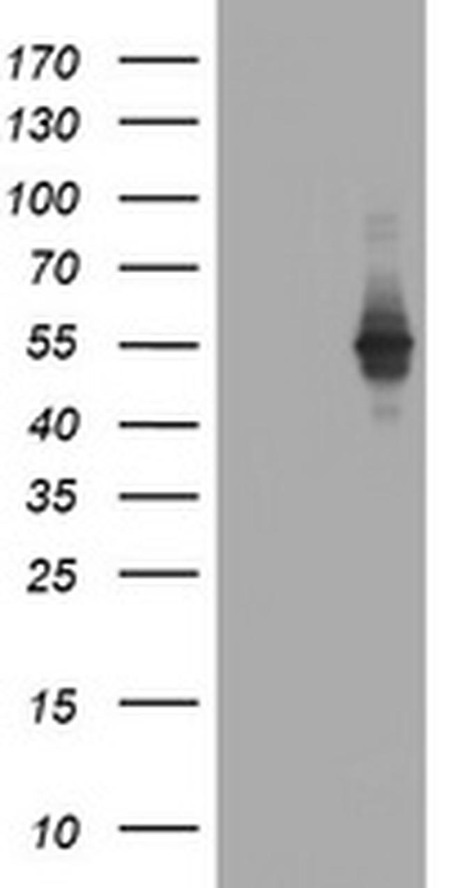 TAPBPL Antibody in Western Blot (WB)