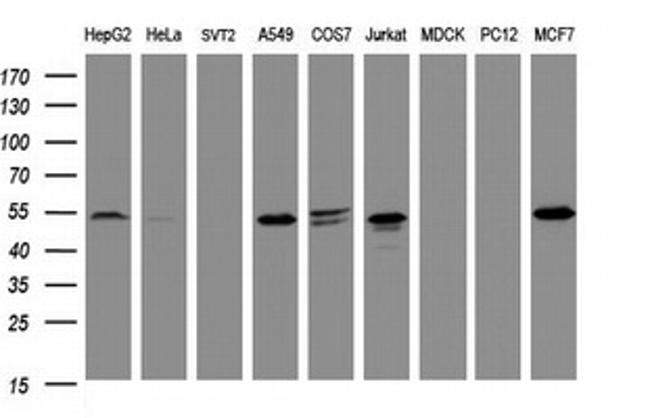 TAPBPL Antibody in Western Blot (WB)