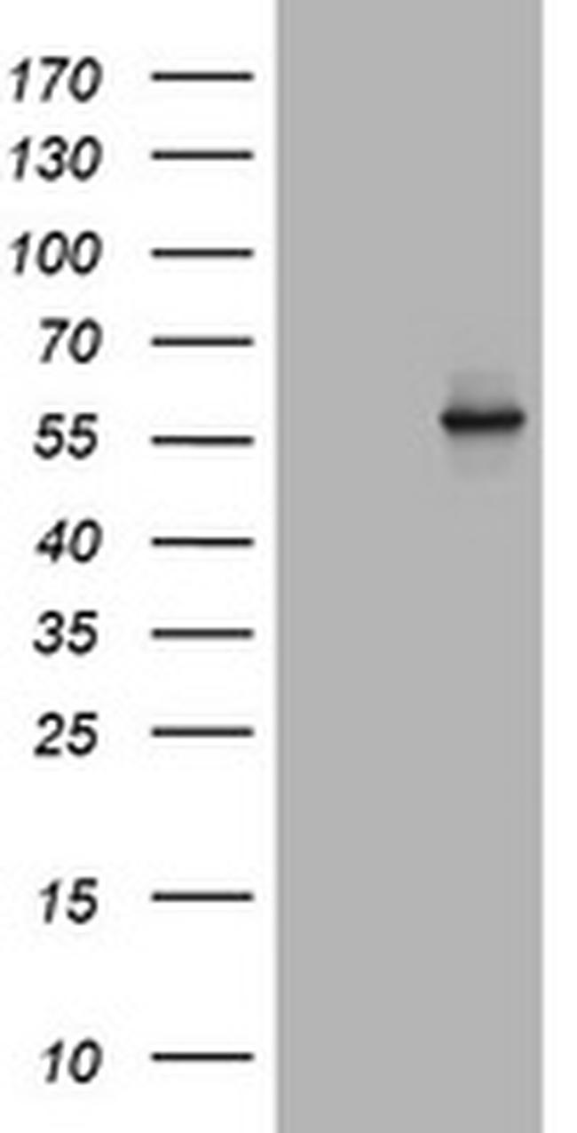 TAPBPL Antibody in Western Blot (WB)