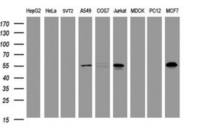 TAPBPL Antibody in Western Blot (WB)