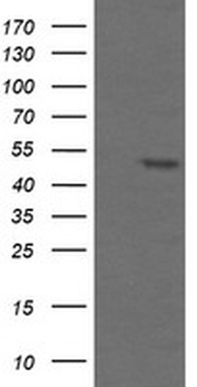 TAPBPL Antibody in Western Blot (WB)