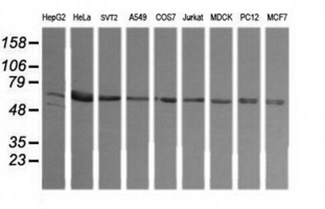 TAPBPL Antibody in Western Blot (WB)