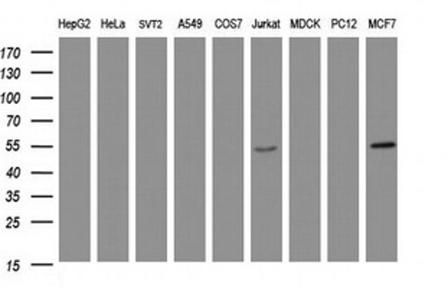 TAPBPL Antibody in Western Blot (WB)