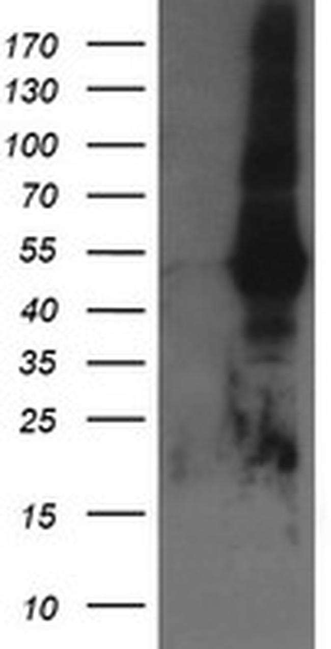 TAPBPL Antibody in Western Blot (WB)