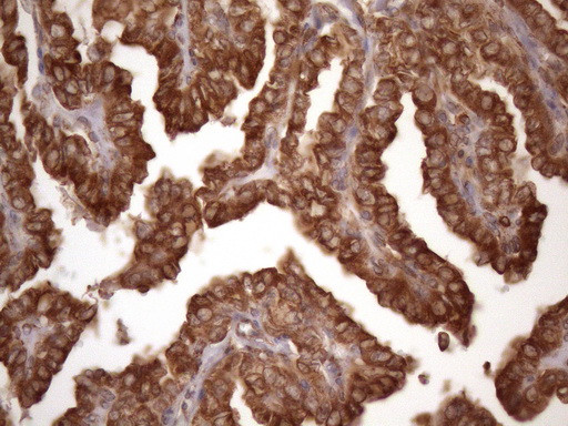 TARBP2 Antibody in Immunohistochemistry (Paraffin) (IHC (P))