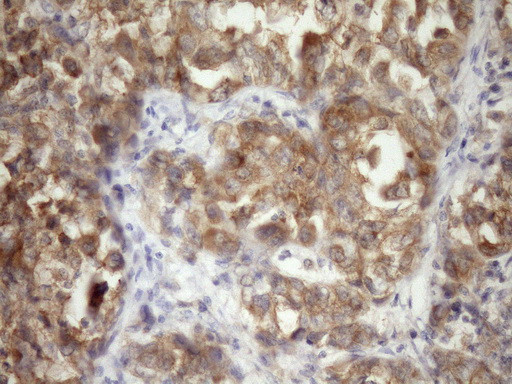 TARBP2 Antibody in Immunohistochemistry (Paraffin) (IHC (P))