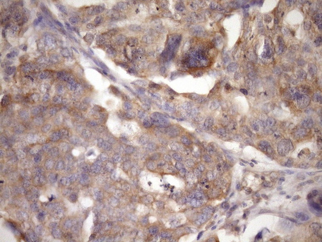 TARBP2 Antibody in Immunohistochemistry (Paraffin) (IHC (P))