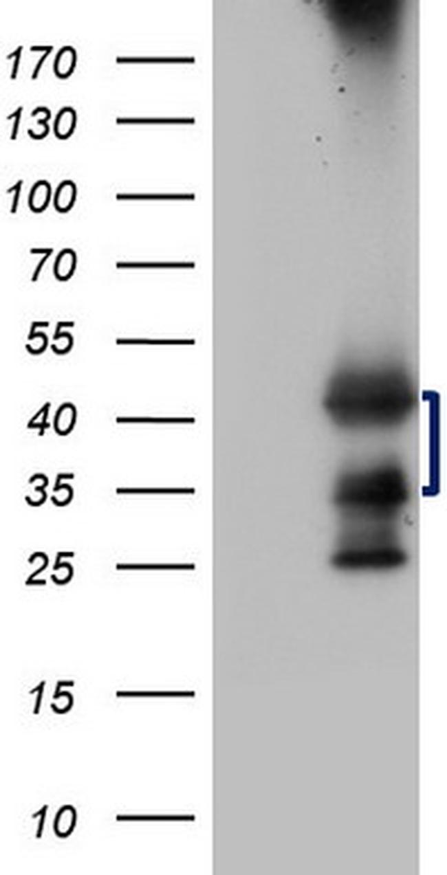 TARBP2 Antibody in Western Blot (WB)