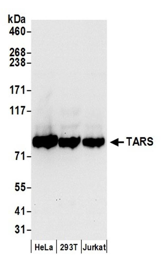 TARS Antibody in Western Blot (WB)